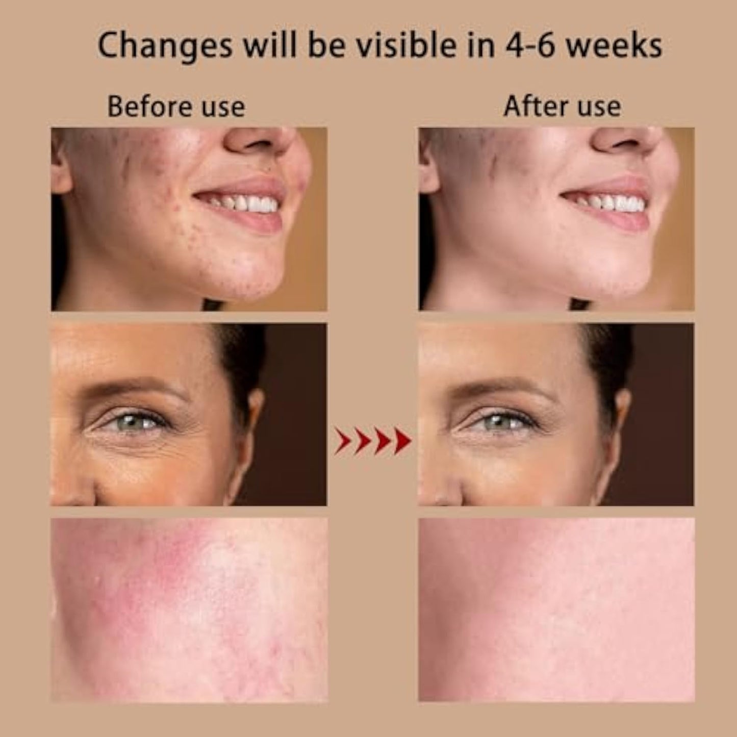 Colorful Silicone Photorejuvenator Beauty Mask Ultra-light