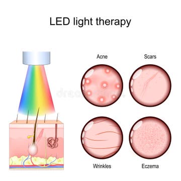 Can Red Light Therapy Masks Really Improve Skin? The Science Behind It