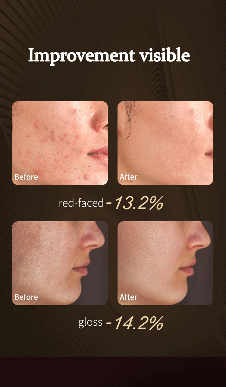 7 Colors Led Red Light Therapy Mask for Face
