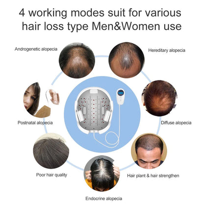 Laser Hair Growth Helmet – 650nm Red Light & Infrared Therapy for Hair Regrowth