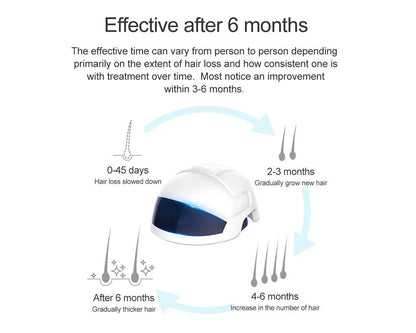 Laser Hair Growth Helmet – 650nm Red Light & Infrared Therapy for Hair Regrowth