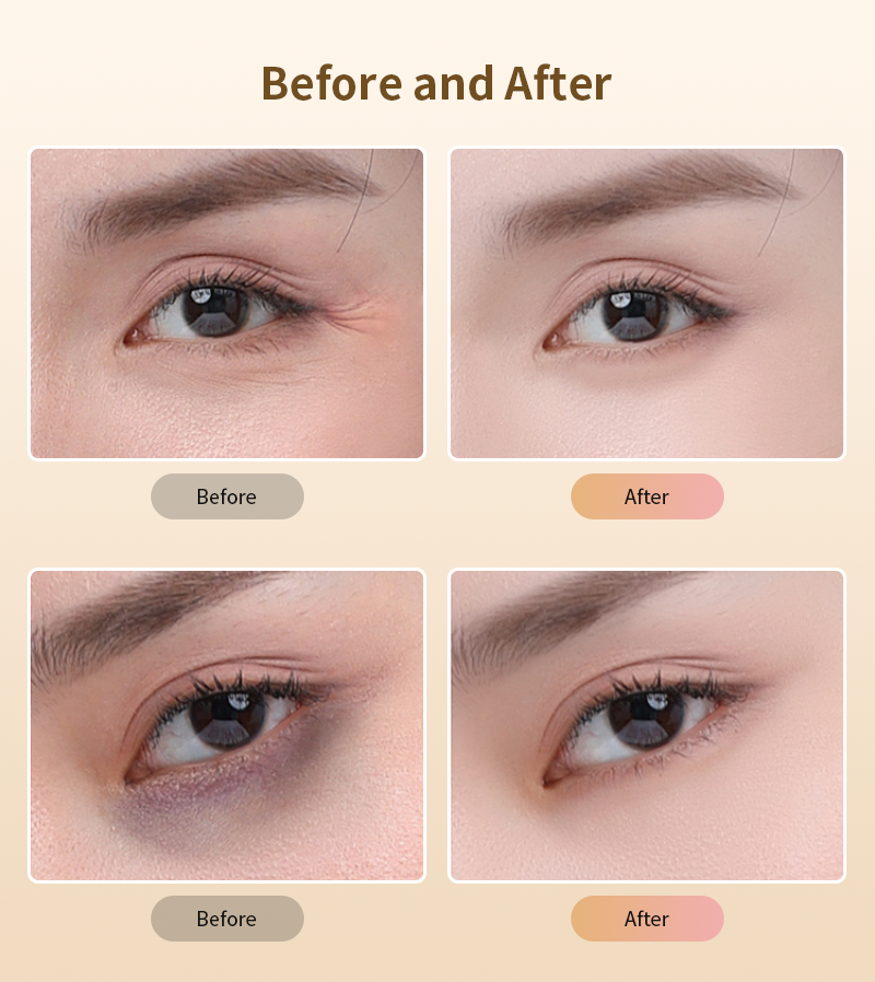 Red Light Therapy Eye Mask – Anti-Aging, Dark Circle Reduction, and Skin Firming Therapy
